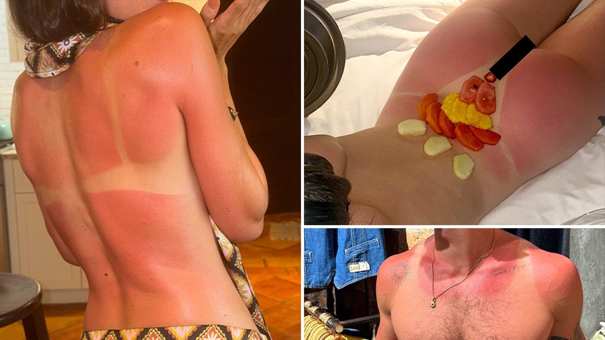 Hollywood Stars Burned by Sun - Guess Who?